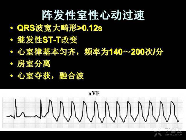 阵发性室上性心动过扑_心室扑动室性心动过速_阵发性心房扑动的治疗
