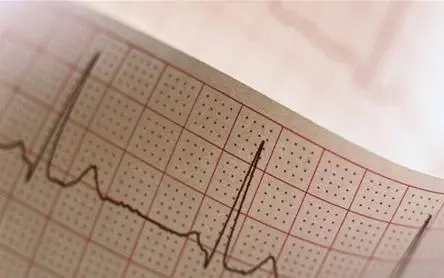 阵发性室上性心动过速的治疗-阵发性室上性心动过速：心跳风暴来袭，如何应对？
